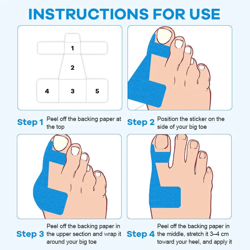 🔥💞LAST DAY 50% OFF ✨Bunion Relief Toe Correction Wrap